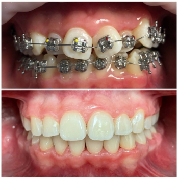 hrechkovskyi-orthodontics-services